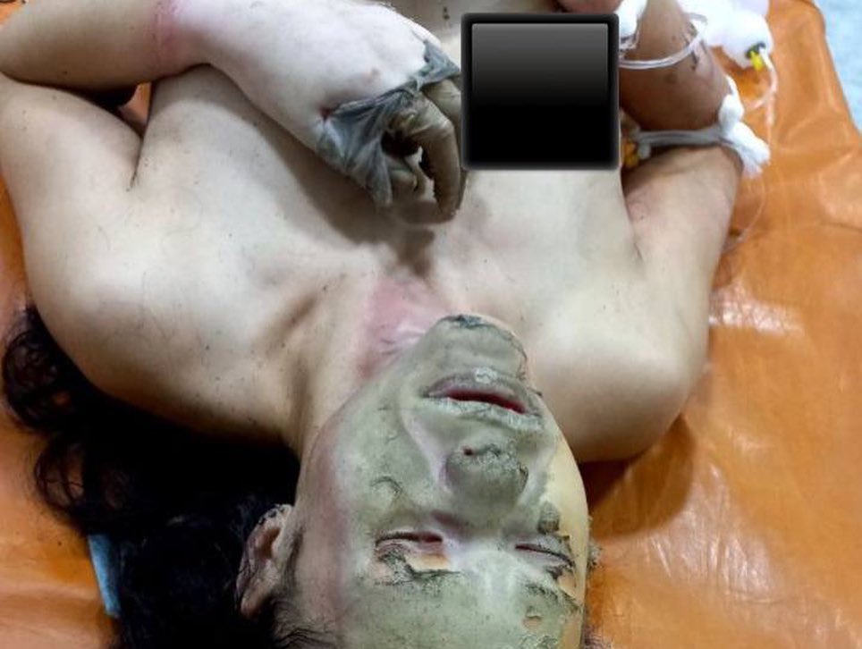 Женщина находится в тяжелом состоянии - фото: instagram.com/bf_emotion