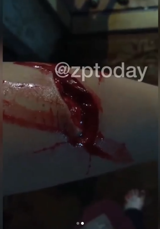 Последствия смерча - фото: inst zptoday