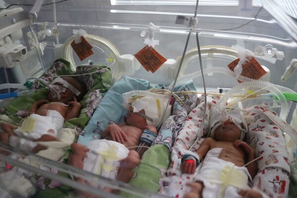 Неожиданный сюрприз: как себя чувствует тройня, рожденная в Запорожье фото 5