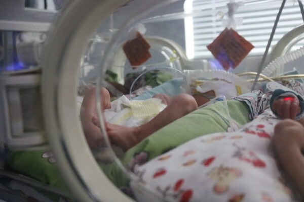 Неожиданный сюрприз: как себя чувствует тройня, рожденная в Запорожье фото 6