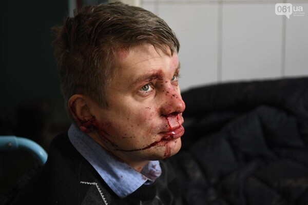 В Запорожье избили депутата облсовета: как он себя чувствует (фото 18+) фото